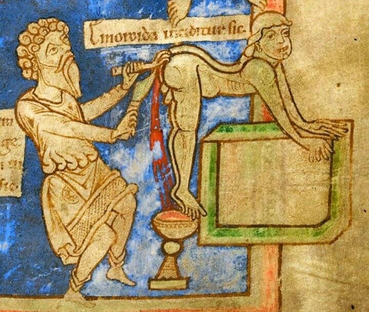 medicina medieval para el tratamiento de las hemorroides